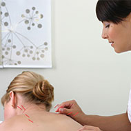 Treating Eczema with Acupuncture