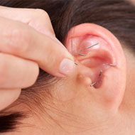 Auricular Acupuncture For Pain Relief